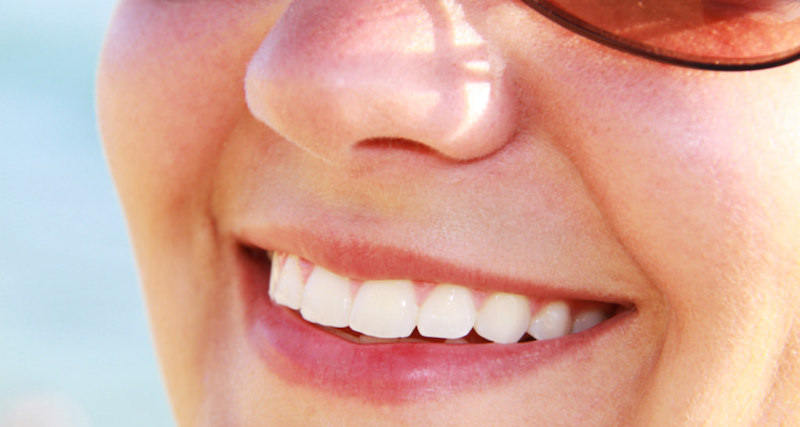 woman smiling after a root canal